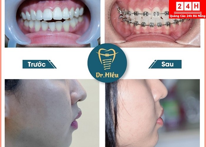 nha-khoa-uy-tin-tai-binh-duong (12)
